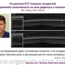 Ибатулин Р.А. Линза «Perifocal» новый способ очковой коррекции и контроля прогрессирования близорукости у детей путем воздействия на периферическую рефракцию. "Линзы с горизонтальной прогрессией «Perifocal» и «Anlauf»: современная стратегия оптической коррекции зрения" - первая конференция с международным участием, посвященная  новому направлению в современной оптометрии.  20 февраля 2014г., г. Москва, Россия. Информационный партнер www.organum-visus.com