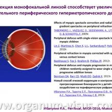 Ибатулин Р.А. Линза «Perifocal» новый способ очковой коррекции и контроля прогрессирования близорукости у детей путем воздействия на периферическую рефракцию. "Линзы с горизонтальной прогрессией «Perifocal» и «Anlauf»: современная стратегия оптической коррекции зрения" - первая конференция с международным участием, посвященная  новому направлению в современной оптометрии.  20 февраля 2014г., г. Москва, Россия. Информационный партнер www.organum-visus.com