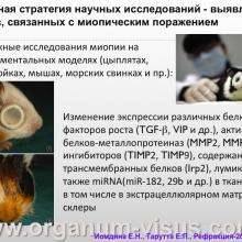 Иомдина Е.Н., Тарутта Е.П. (МНИИ ГБ им. Гельмгольца. Доклад на конференции Рефракция-2014, г. Самара, Россия. Информационный партнер портал Орган зрения www.organum-visus.com