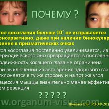 Жукова О.В. Морфология глазодвигательных мышц при косоглазии. Доклад на РООФ-2013 (AROF-2013) Информационный партнер www.organum-visus.com