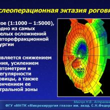 Майчук Н.В. Кератоконус и кераторефракционная хирургия: мифы и реальность. Доклад на Научно-практической конференции офтальмологов Южного федерального округа с участием специалистов Прикаспийских государств "Инновационные технологии в офтальмологической практике регионов" (г. Астрахань, Россия, 10-11 октября 2014г.). Информационный партнер офтальмологический портал Орган зрения www.organum-visus.com