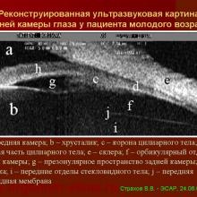 Аккомодация - Страхов В.В.