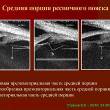 Аккомодация - Страхов В.В.