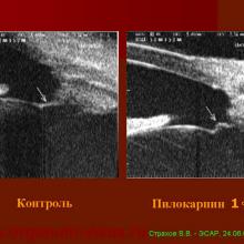 Аккомодация - Страхов В.В.