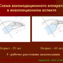 Аккомодация - Страхов В.В.