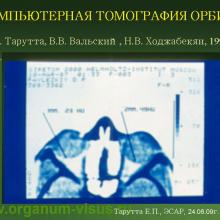 Аккомодация и рефрактогенез