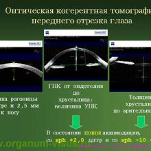 Тарутта Е.П. Аккомодация и рефрактогенез. Экспертный совет по рефракции и аккомодации, ЭСАР, Board of Accommodation and Refraction, SABAR. Заседание 1, 24 июня 2009г. Клуб Знатоков офтальмологии на www.organum-visus.com