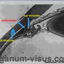 Воронцова Т.Н. Нарушения аккомодации и их лечение (Accommodation disturbances and their treatment). Лекция для офтальмологов, оптиков, оптометристов и специалистов, изучающих орган зрения. Портал www.organum-visus.com